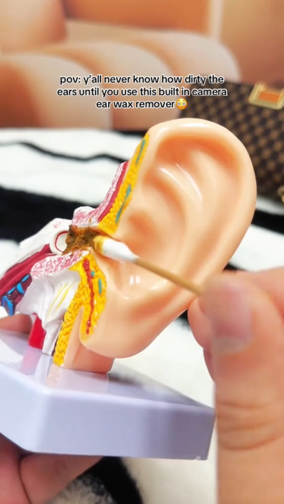 Ear Wax Cleaning Kit with Camera