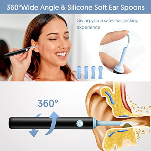 Ear Wax Cleaning Kit with Camera